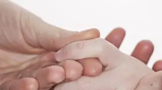Kurzajka na palcu dziecka