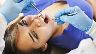 Usuwanie kamienia nazębnego