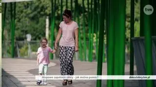 Atopowe zapalenie skóry u dziecka. Dramat całej rodziny