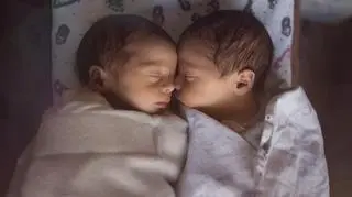 Silna więź bliźniaków. Gdy jeden ważył zaledwie 0,5 kg, drugi motywował go do walki o życie 