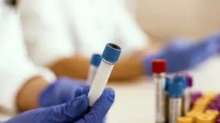 Próbówki laboratoryjne