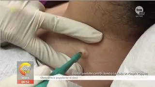 Obrzydzenie. Dla umysłu strasznie kręcące...