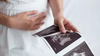 Ministerstwo Zdrowia o zakończeniu ciąży w razie zagrożenia życia lub zdrowia kobiety
