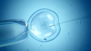 zapłodnienie metodą in vitro 