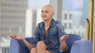 Beata Ławecka straciła włosy prawdopodobnie przez narkozę. Postanowiła, że nie będzie nosić peruk