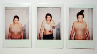 Jako nastolatka nosiła stanik w rozmiarze 75G. Zdecydowała się na zmniejszenie biustu: "Chciałam się uwolnić" 