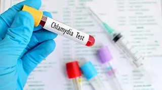 test na chlamydie