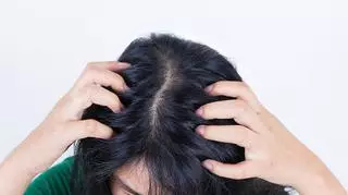 Sucha skóra głowy – jak poradzić sobie z problemem?