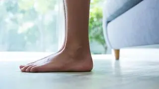 Płaskostopie - kobiece stopy z profilu. Kobieta stoi. 