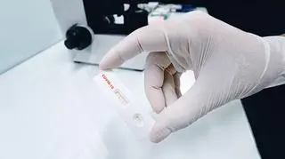 Test na koronawirusa 