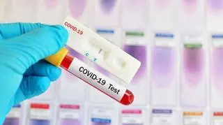 test, COVID-19, koronawirus
