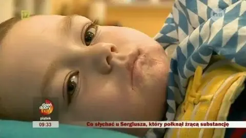Dalsze losy Sergiusza, który połknął żrący detergent