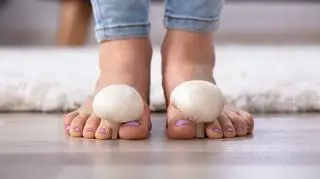 grzybica panokci 