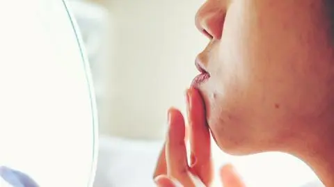 Pokazywanie trądziku - nowy trend na Instagramie. Co to jest skinpositivity?