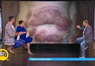 Nowe i niebezpieczne trendy w chirurgii plastycznej. Których zabiegów lepiej unikać?
