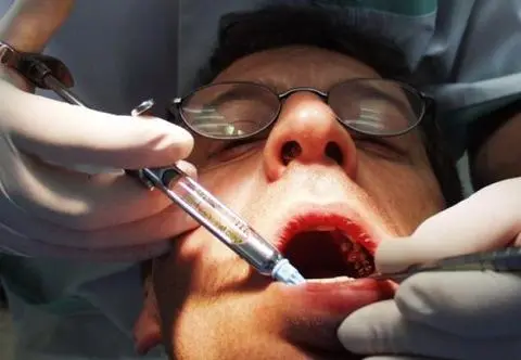 Boicie się dentysty? 