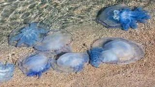 meduza, poparzenie