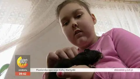 Zespół sztywnego serca - kardiomiopatia restrykcyjna. Objawy, leczenie