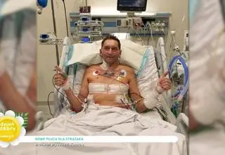 Strażak otarł się o śmierć po COVID-19. Otrzymał od dawcy nowe płuca