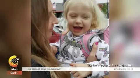 Krew pępowinowa szansą przy dziecięcym porażeniu mózgowym?
