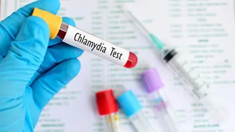 Chlamydia ‒ chlamydia leczenie, objawy u mężczyzn | Dzień Dobry TVN