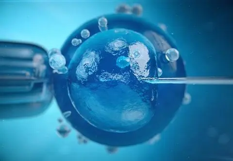 Zapłodnienie in vitro - co to jest, na czym polega? | Dzień Dobry TVN