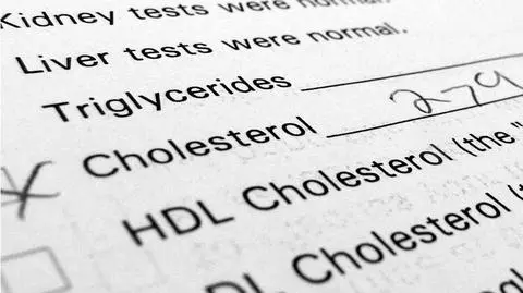 Cholesterol norma - normy dla cholesterolu. Badania | Dzień Dobry TVN