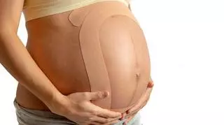 Kinesiotaping niweluje ból w ciąży. Na jakie dolegliwości pomaga?