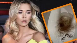 Sandra Kubicka pokazała wypadające włosy 