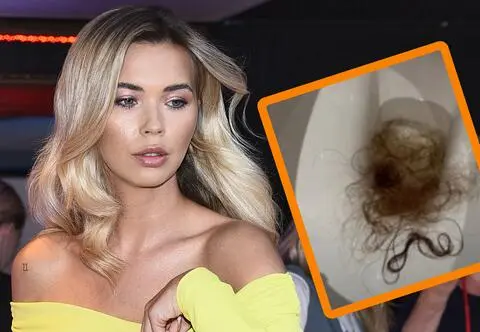 Sandra Kubicka pokazała, ile włosów traci po ciąży