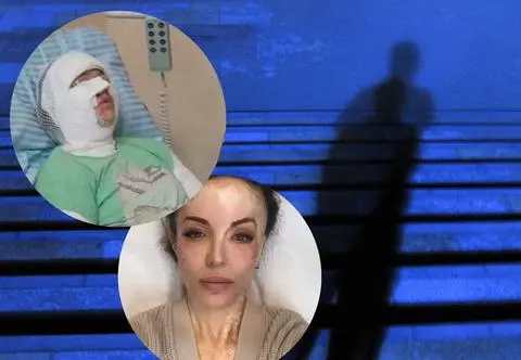 Lata temu stalker oblał ją kwasem. Katarzyna wspomina koszmar i pokazuje zdjęcia zrobione po ataku