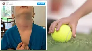 Niewinna zabawka mogła doprowadzić do tragedii. 3-latek był o krok od śmierci