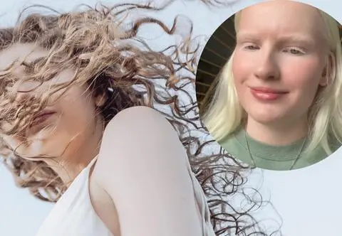 Albinoska walczy ze stereotypami. "Mężczyźni dopytują, czy jestem tam różowa"