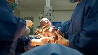 Podczas porodu głowa dziecka oderwała się od ciała