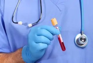 Zmutowany szczep wirusa HIV
