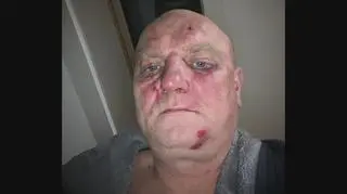 Uwaga! TVN: brutalne pobicie w Łańcucie