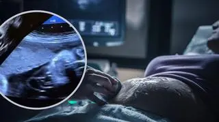 Rodzice pokazali nagranie z ciążowego USG. "Twarz demona" 