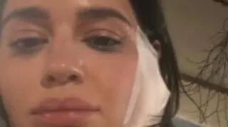 InstaStory Honoraty Skarbek