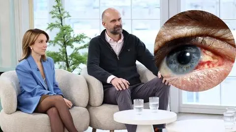 Skąd się bierze wylew w oku? "Najbardziej dramatycznie wyglądający problem"