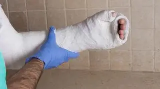 Podhalańskie szpitale oblężone. "Na urazówce pomagamy od 50 do 100 osobom dziennie"