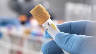 Wzrasta liczba nosicieli HIV. Cztery osoby dziennie słyszą diagnozę