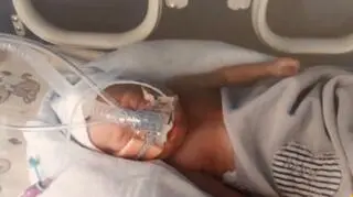 Skrajne wcześniaki - szczęśliwy finał walki o zdrowie i życie