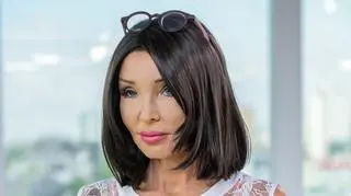 Ewa Minge o chorobie onkologicznej i problemach z wyglądem