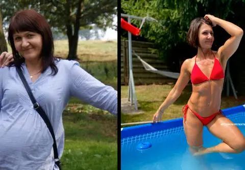 Mimo uszkodzenia kręgosłupa schudła 25 kilogramów. "Byłam przeszczęśliwa"