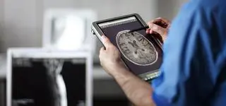 Udar mózgu – jak się przed nim uchronić? 