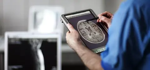 Udar mózgu – jak się przed nim uchronić? 