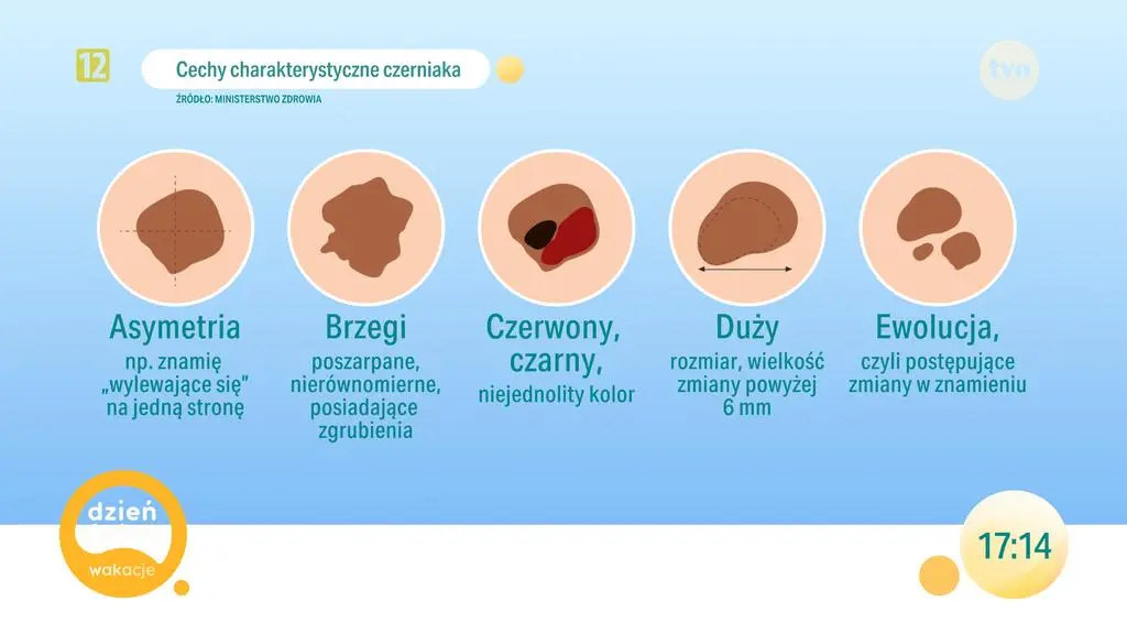 Cechy charakterystyczne czerniaka