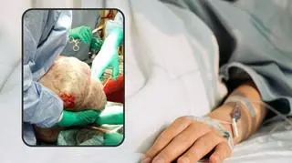 Polscy lekarze wycięli pacjentce ogromnego guza. "Stanowił 1/3 masy jej ciała"