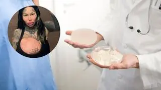 Miała niecodzienny wypadek. Wybuchł jeden z jej 10-kilogramowych implantów piersi