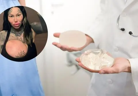 Miała niecodzienny wypadek. Wybuchł jeden z jej 10-kilogramowych implantów piersi